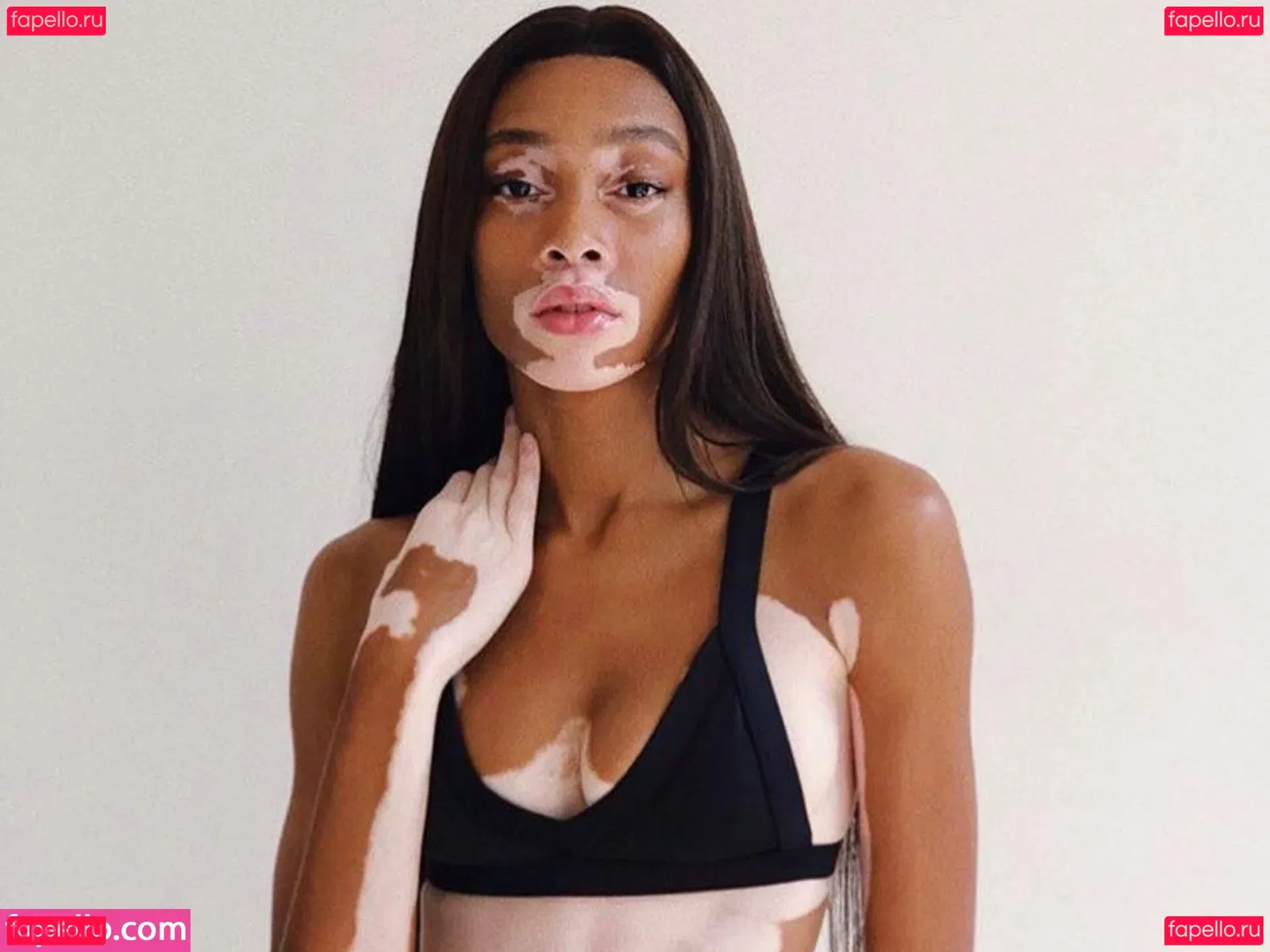 Winnie Harlow Onlyfans Photo Gallery 