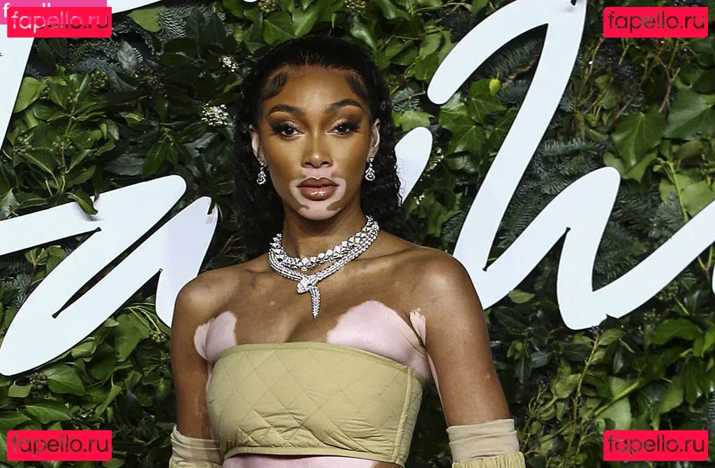 Winnie Harlow Onlyfans Photo Gallery 