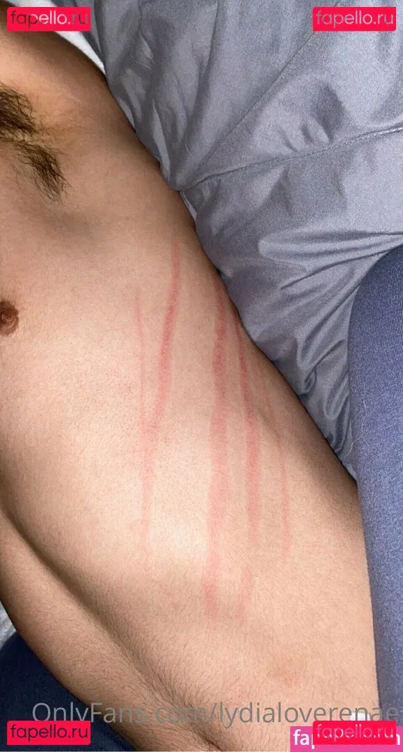 lydialoverenae Onlyfans Photo Gallery 