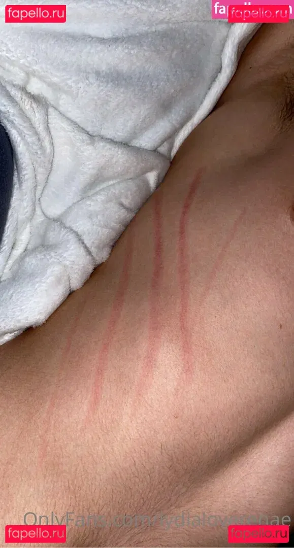 lydialoverenae Onlyfans Photo Gallery 