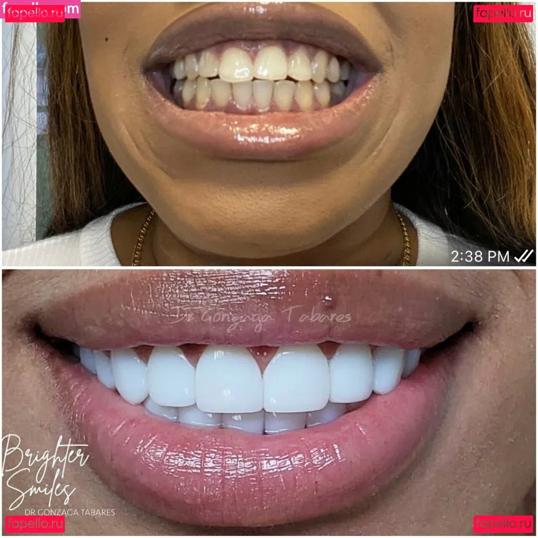 kookooforcocopuffs Onlyfans Photo Gallery 