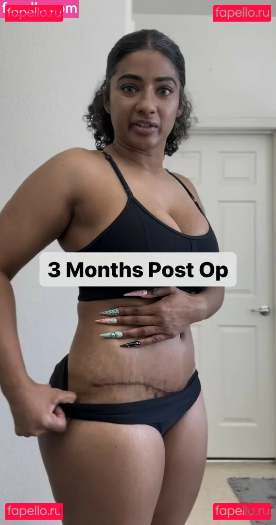 MzKora Onlyfans Photo Gallery 