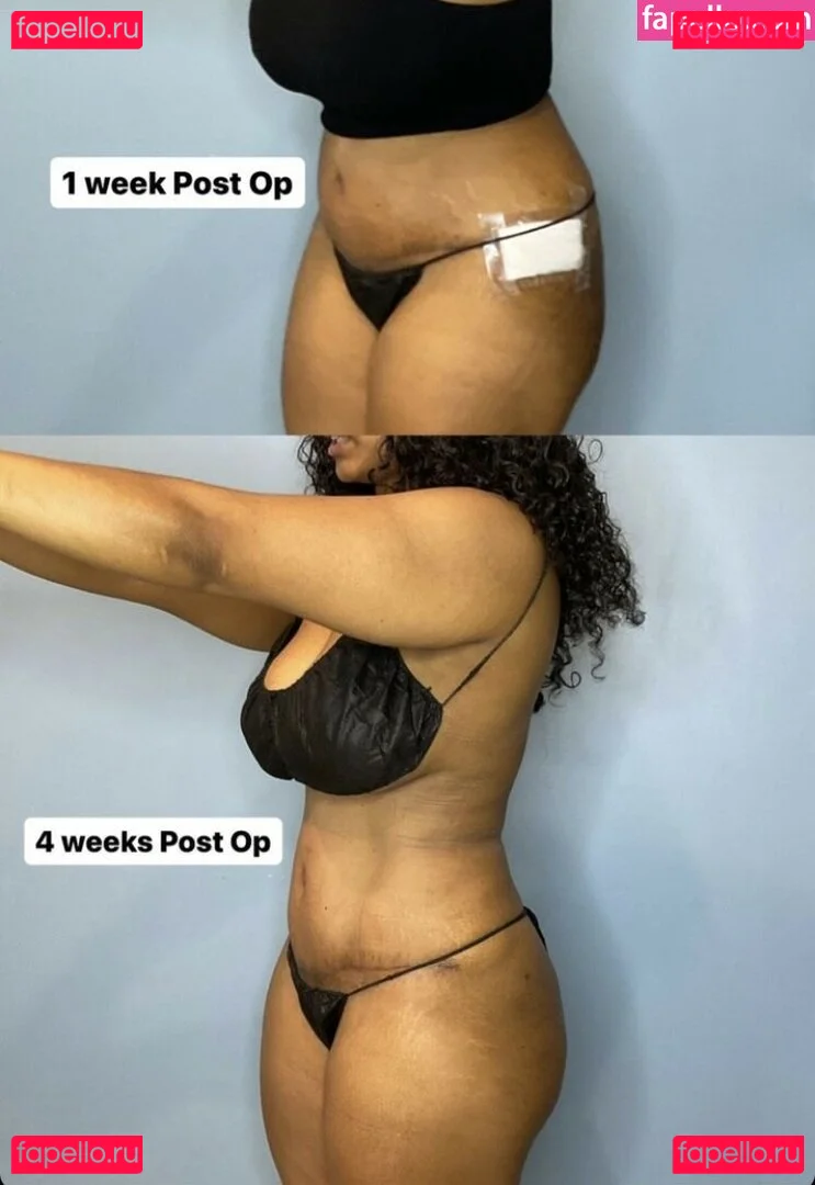 MzKora Onlyfans Photo Gallery 