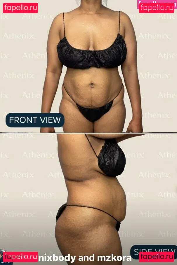 MzKora Onlyfans Photo Gallery 