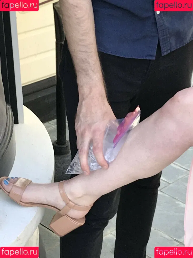 Allison Raskin Onlyfans Photo Gallery 