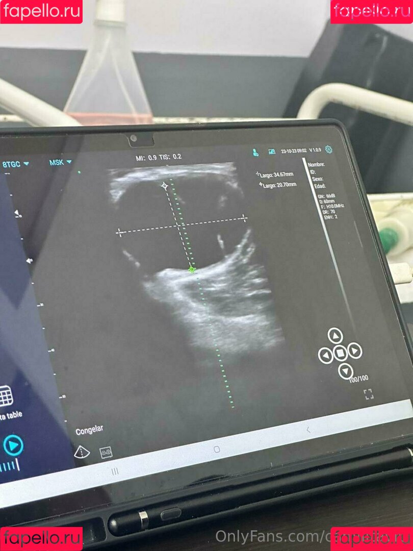 Alejandra Onlyfans Photo Gallery 