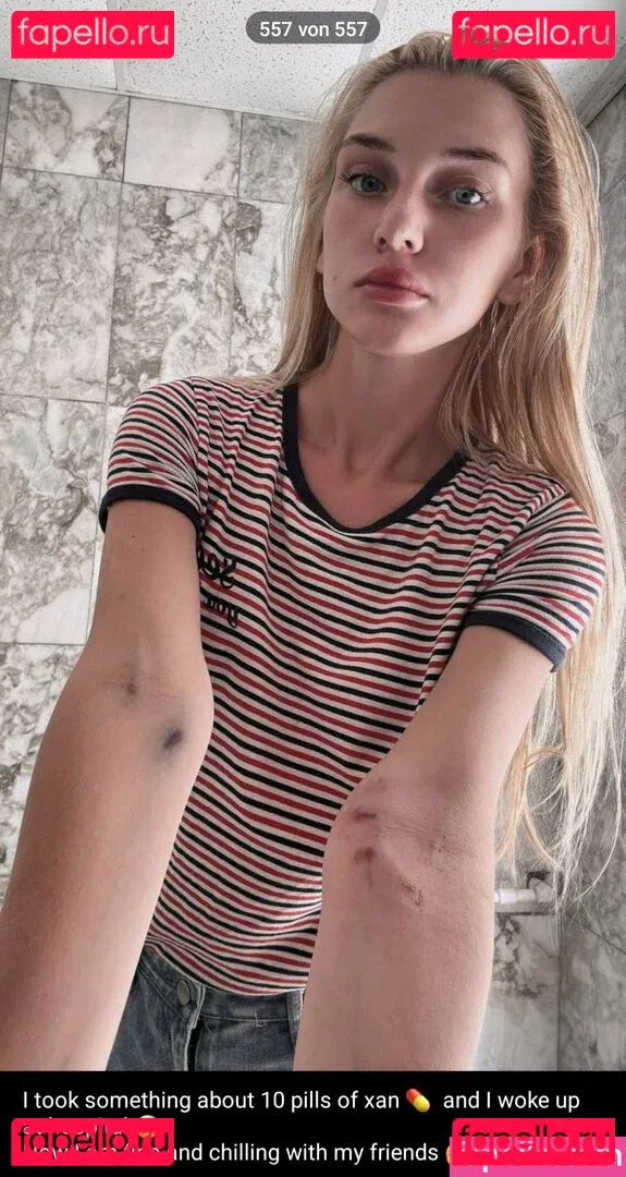 Aprikosin Onlyfans Photo Gallery 