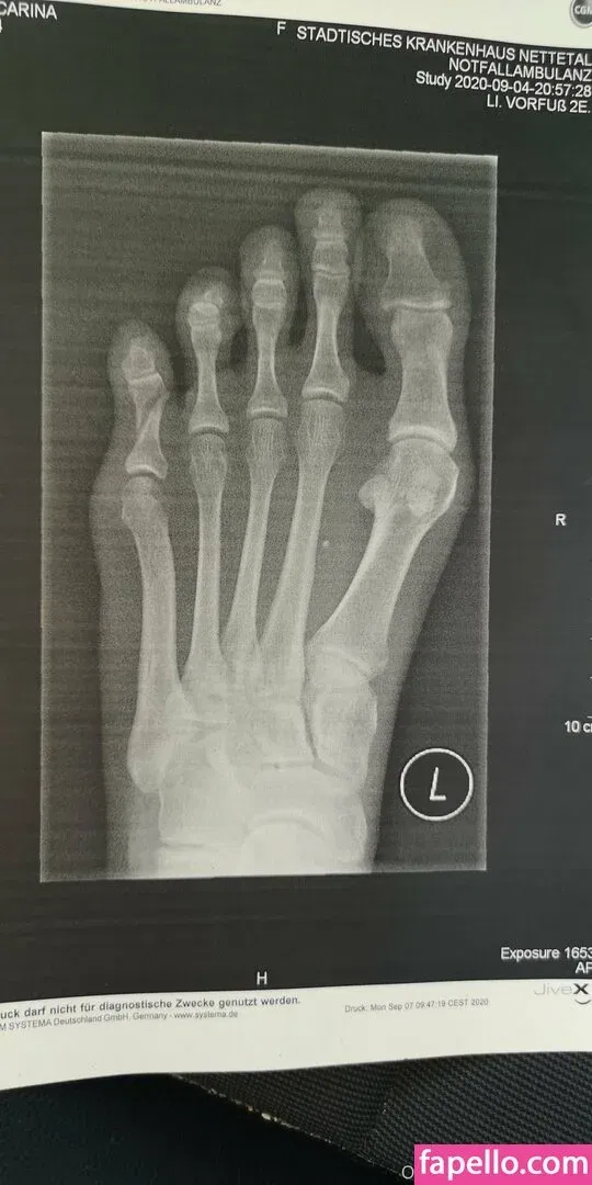 birki-heaven Onlyfans Photo Gallery 