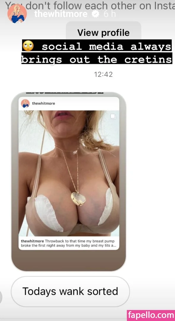 Laura Whitmore Onlyfans Photo Gallery 