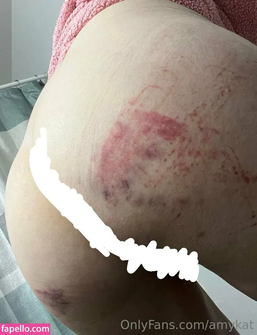 amykat Onlyfans Photo Gallery 