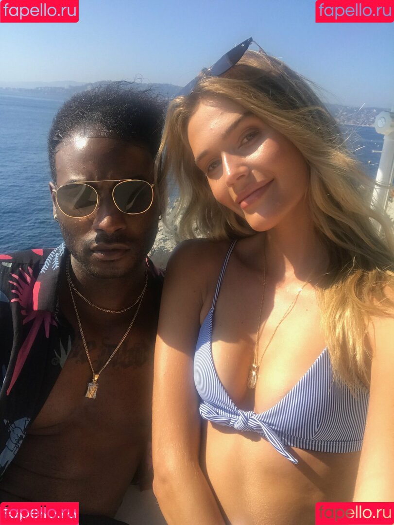 Noel Berry Onlyfans Photo Gallery 