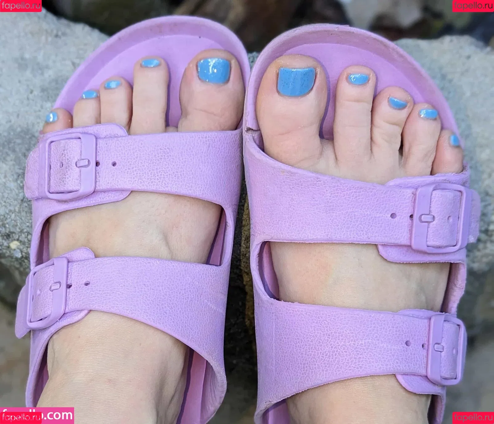 FrecklesAndFelines Onlyfans Photo Gallery 