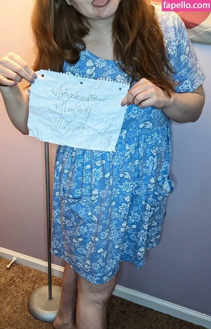 FrecklesAndFelines Onlyfans Photo Gallery 