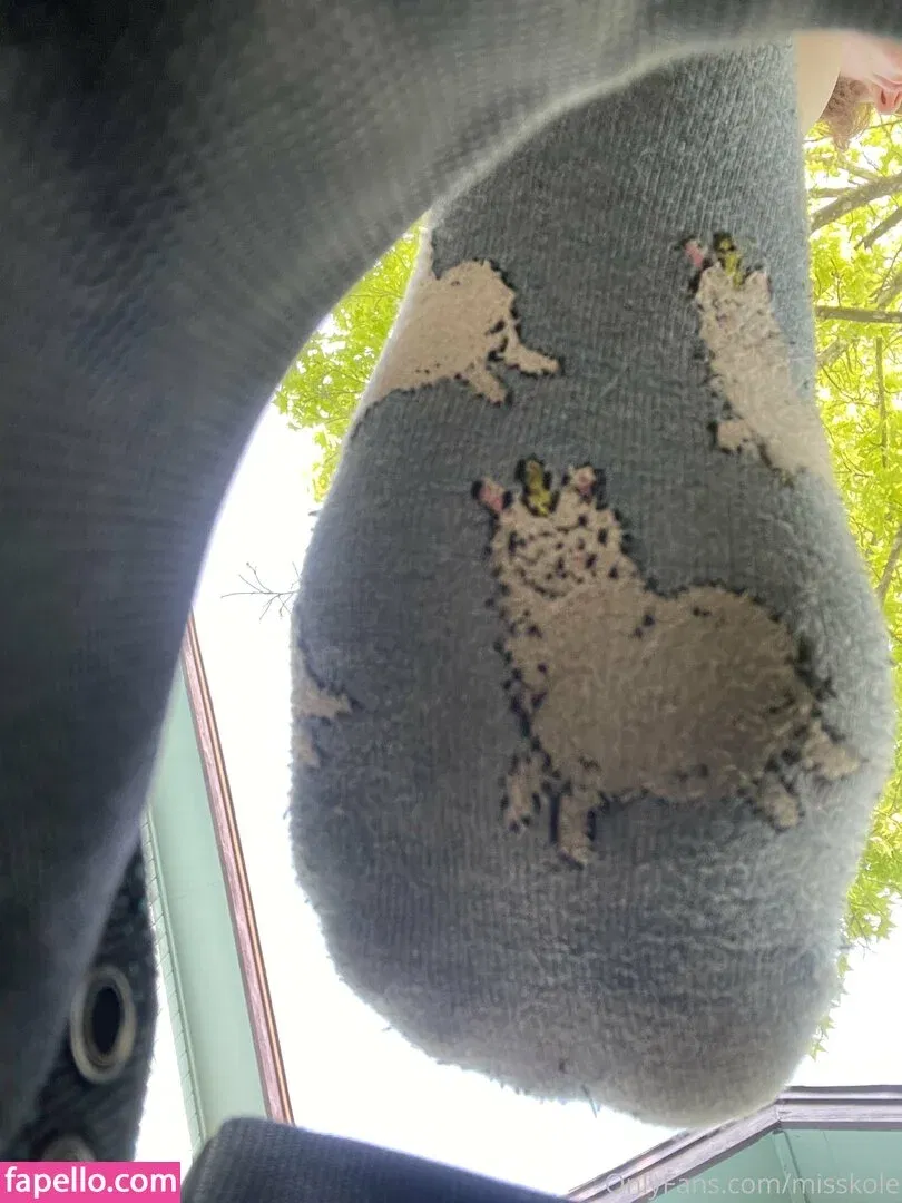 holykoley / luvurteeth Onlyfans Photo Gallery 