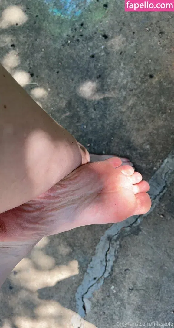 holykoley / luvurteeth Onlyfans Photo Gallery 