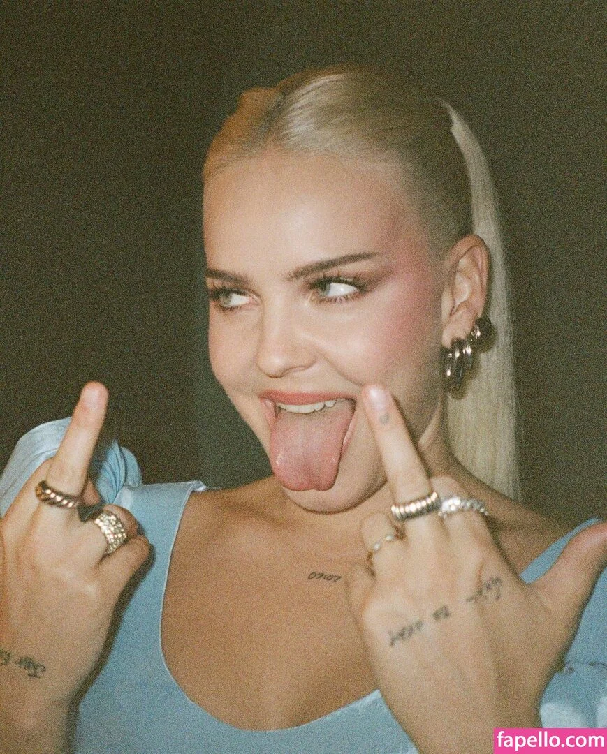 Anne-Marie Onlyfans Photo Gallery 