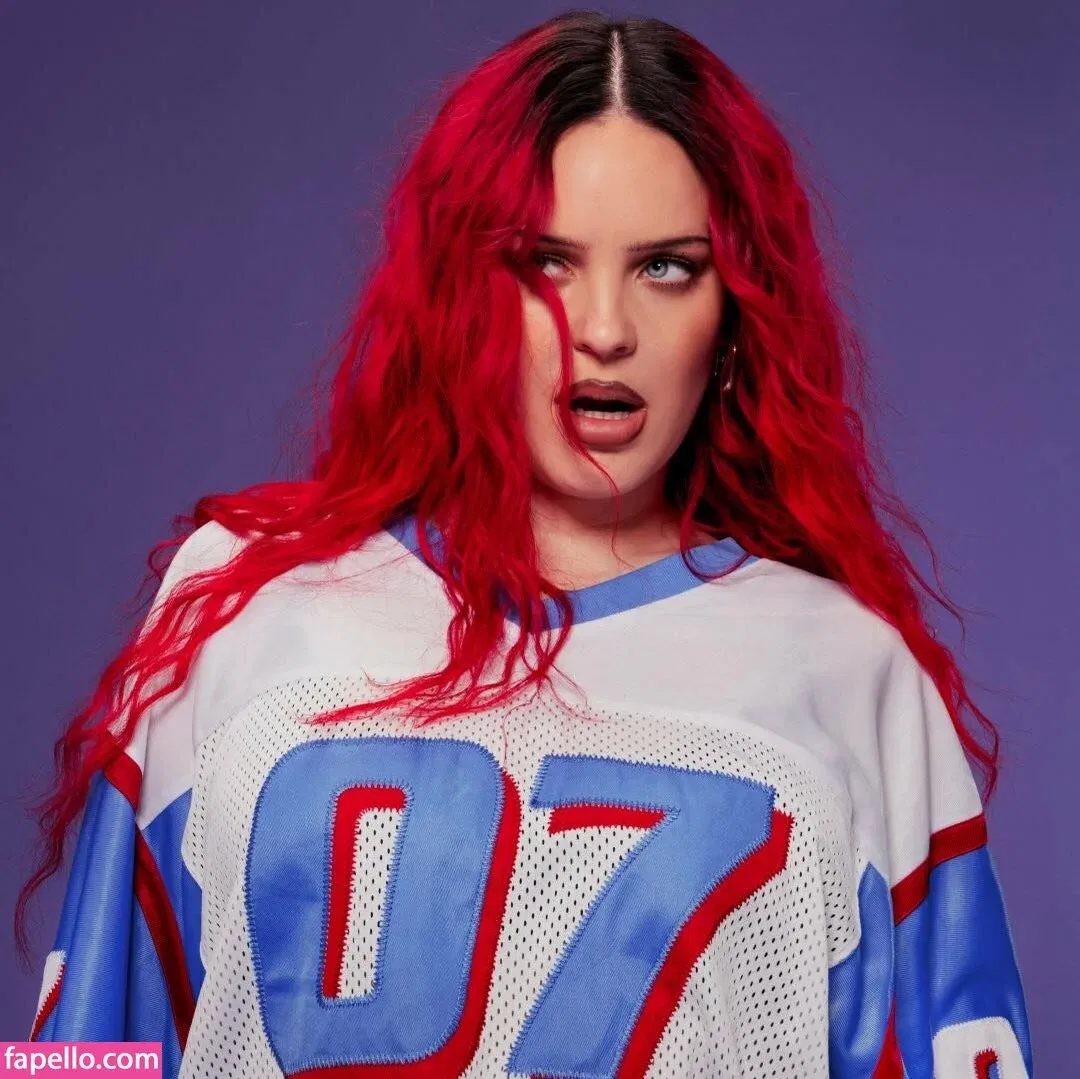 Anne-Marie Onlyfans Photo Gallery 