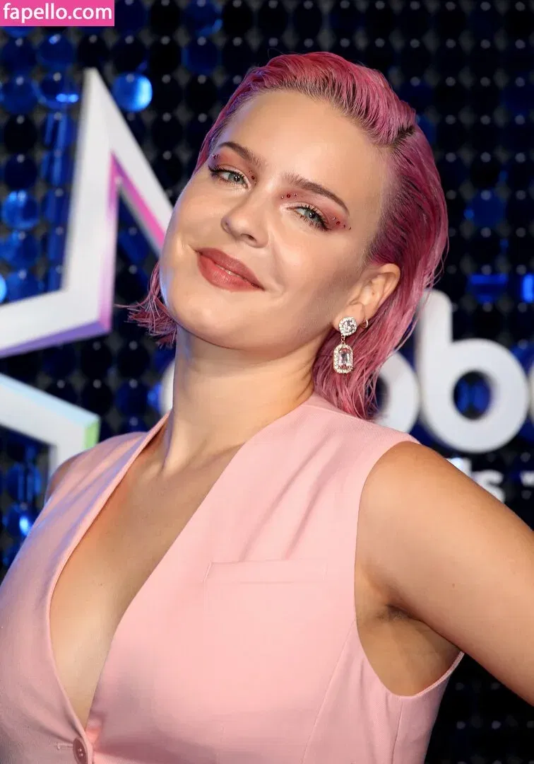 Anne-Marie Onlyfans Photo Gallery 