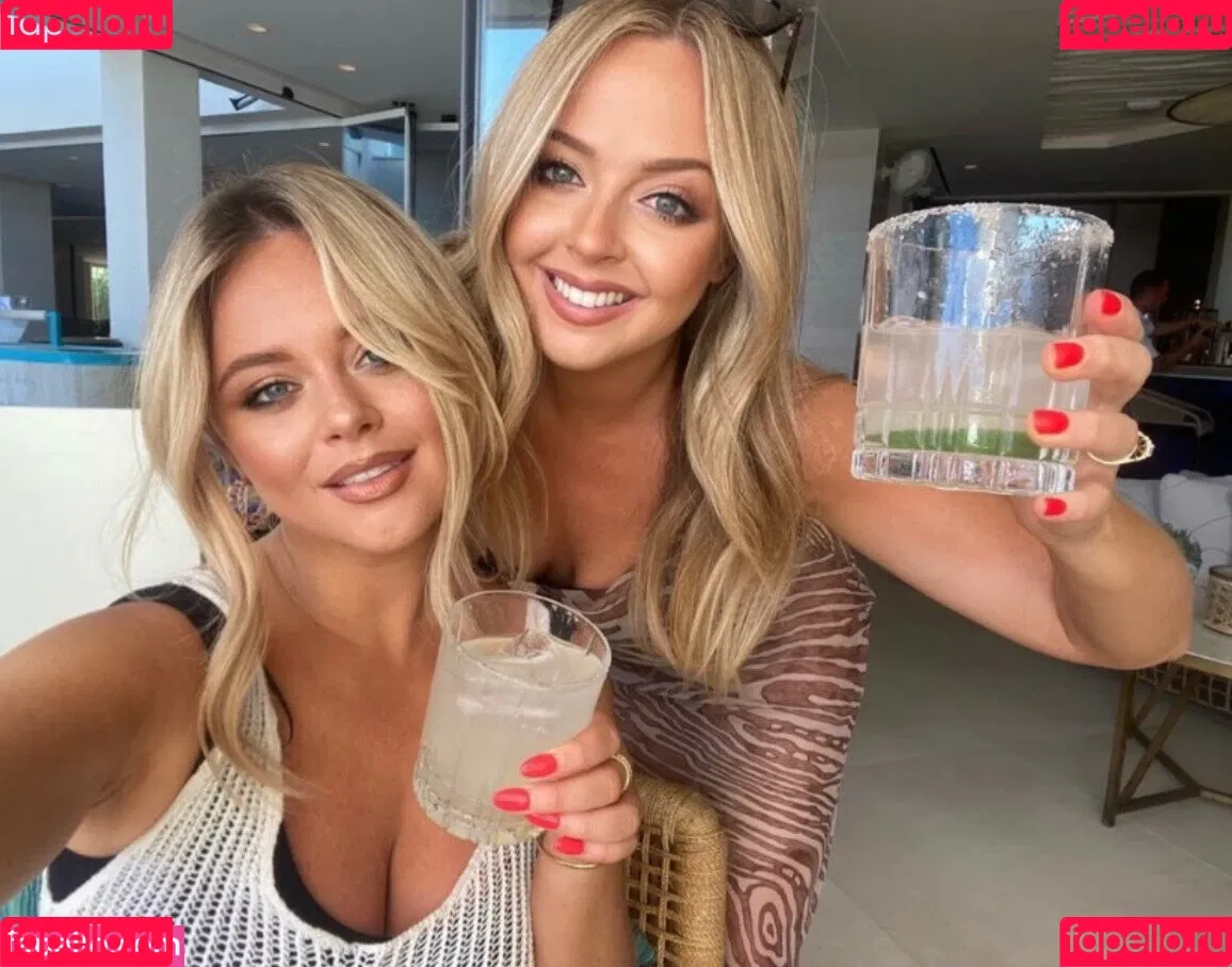 Emily Atack / emilyatack Onlyfans Photo Gallery 