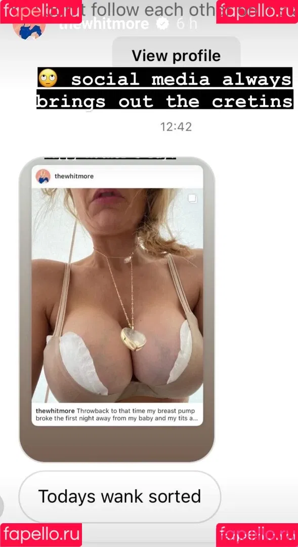 Laura Whitmore / thewhitmore Onlyfans Photo Gallery 