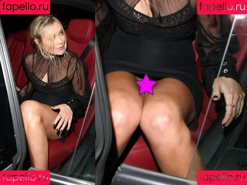 Laura Whitmore / thewhitmore Onlyfans Photo Gallery 