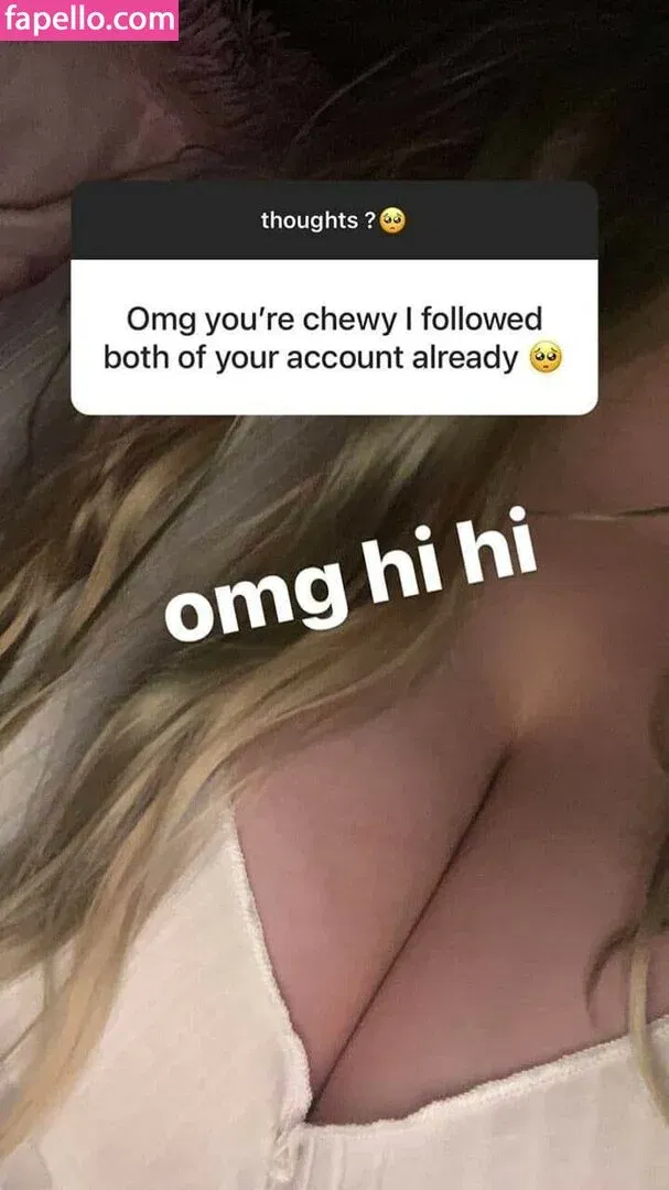 Chewys.melons Onlyfans Photo Gallery 
