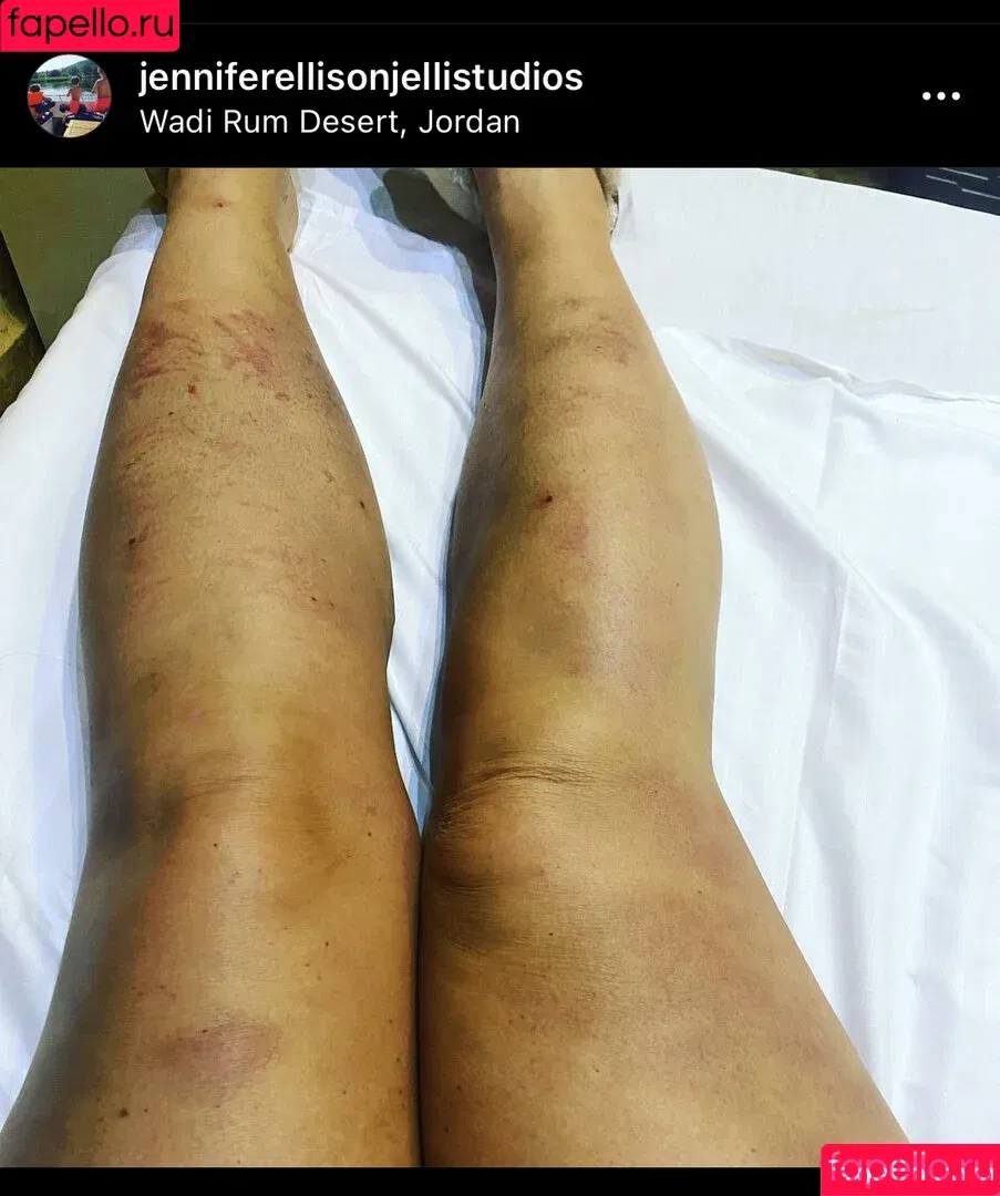 Jennifer Ellison / jenniferellisonjellistudios Onlyfans Photo Gallery 