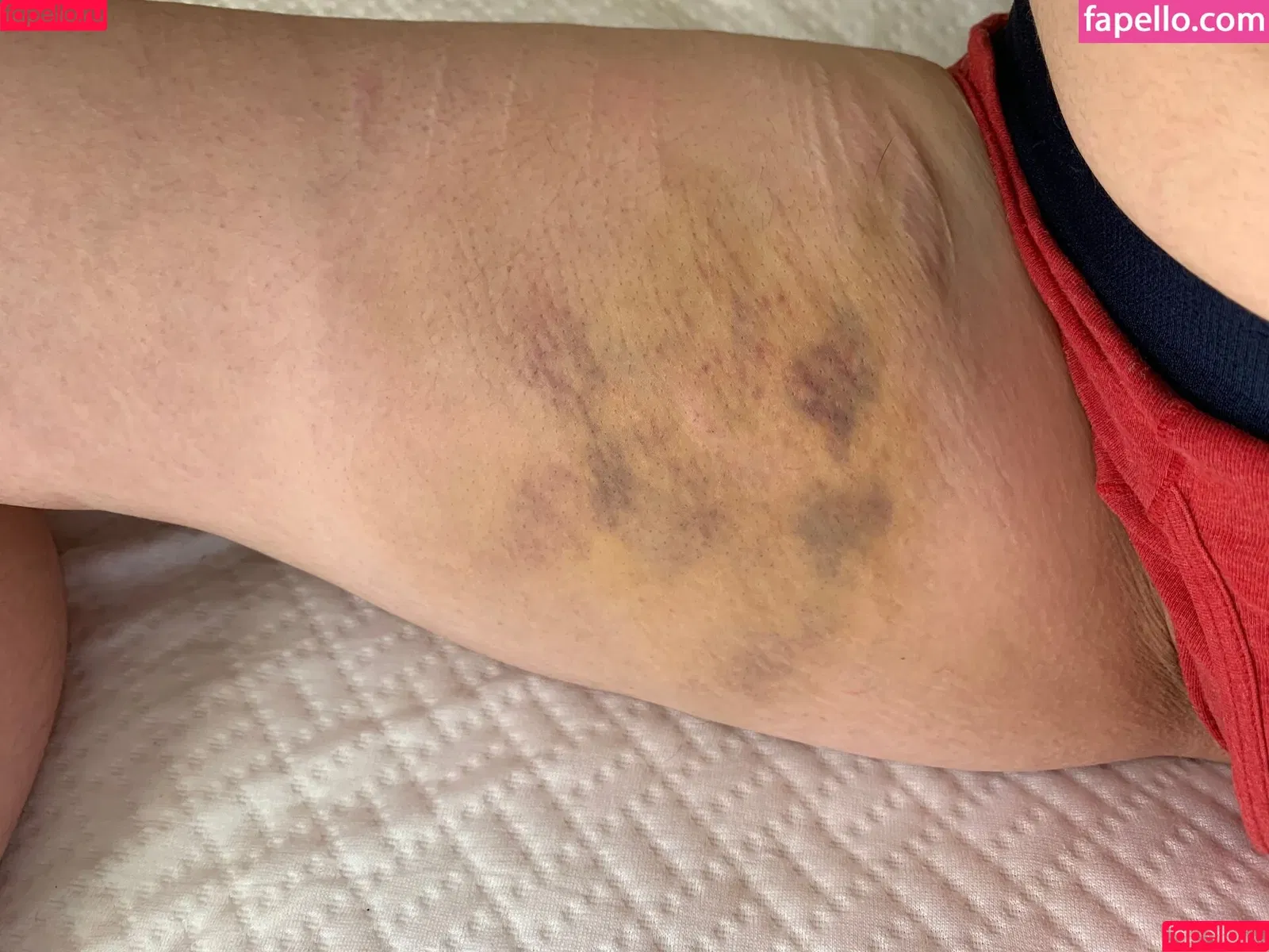 dentata69 / punishmentslut Onlyfans Photo Gallery 