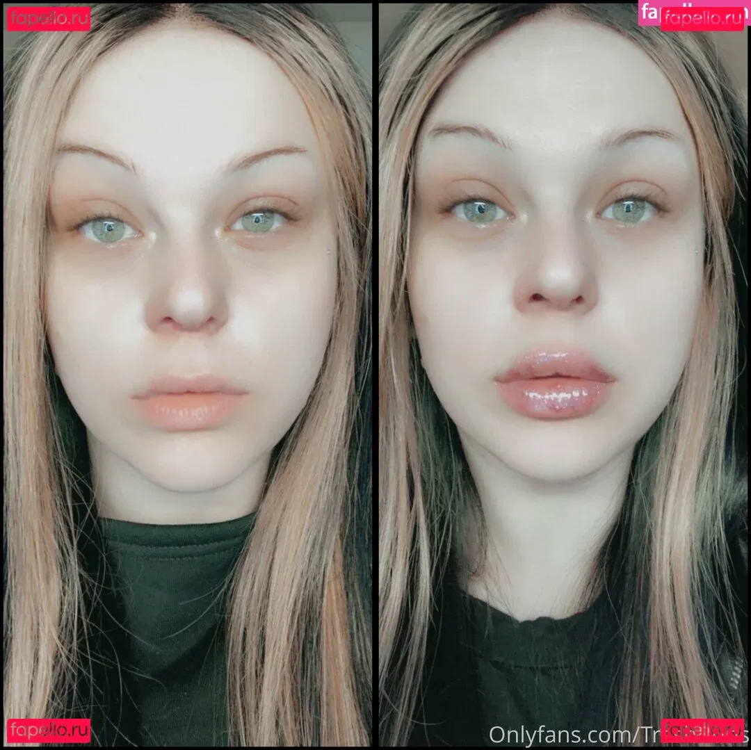 trashbuns Onlyfans Photo Gallery 