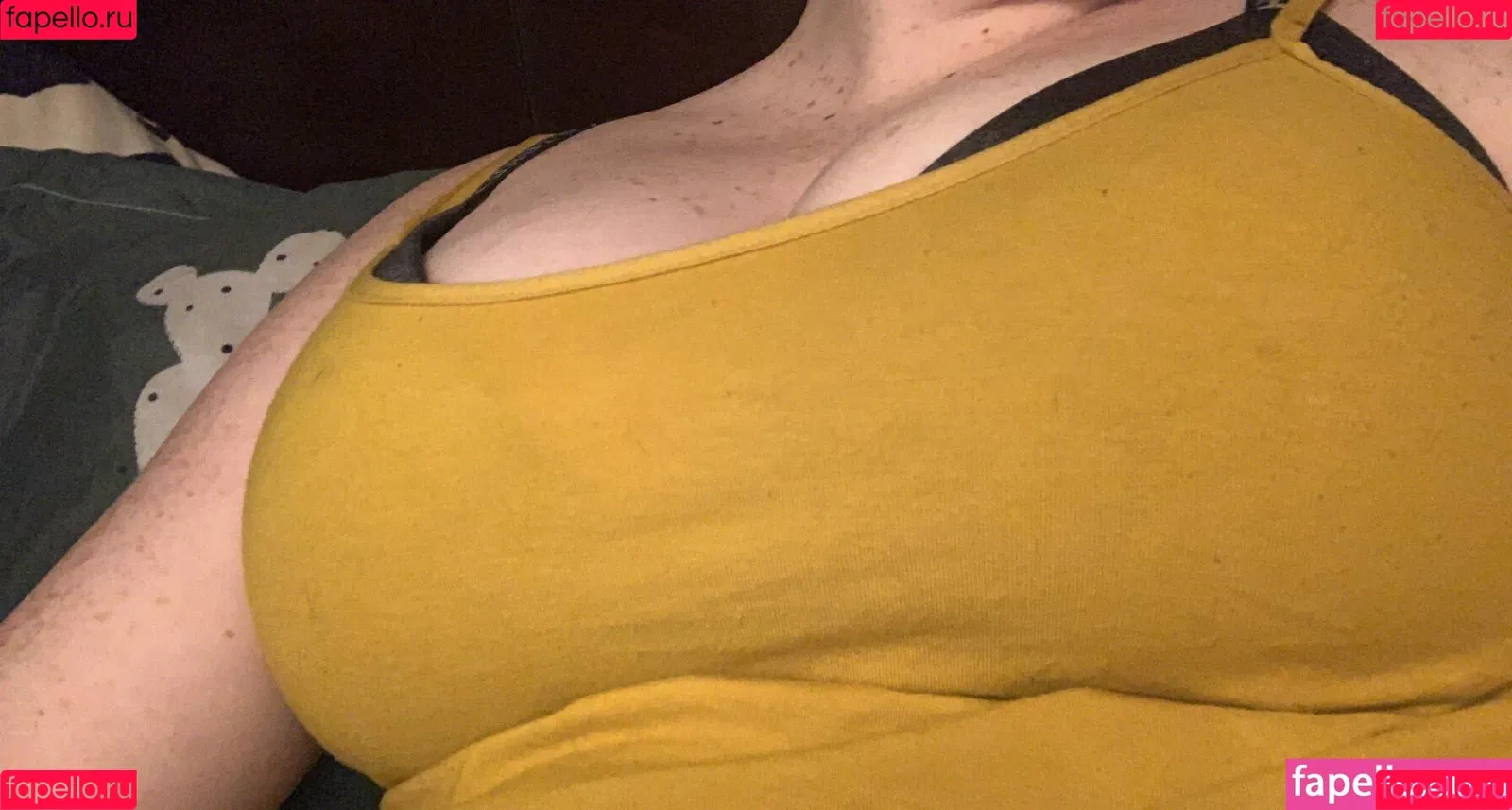 Polymorphed Onlyfans Photo Gallery 