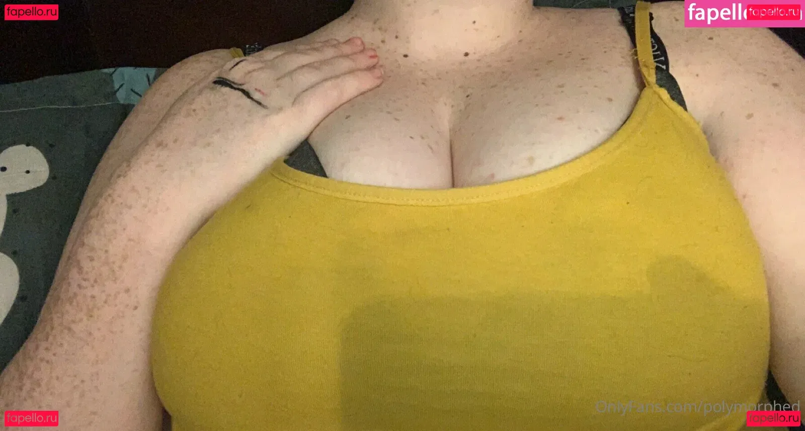 Polymorphed Onlyfans Photo Gallery 