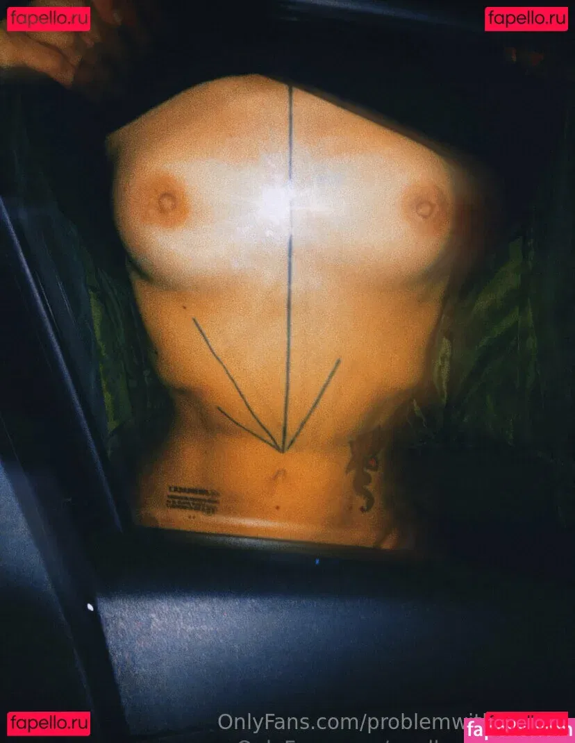 problemwiththesun Onlyfans Photo Gallery 