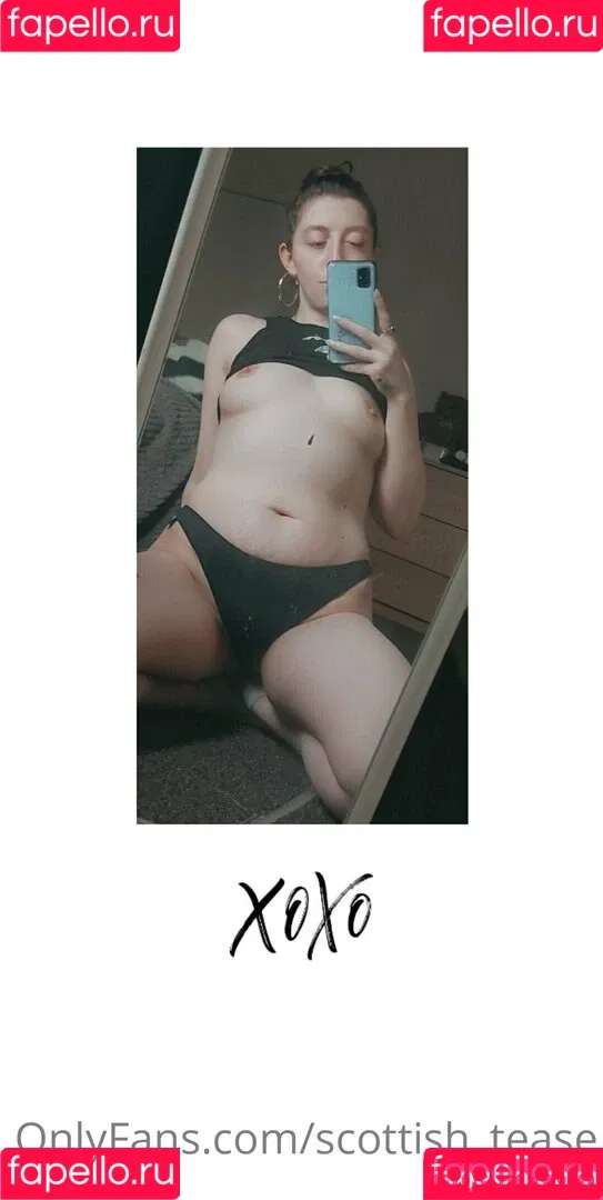 scottish_tease Onlyfans Photo Gallery 