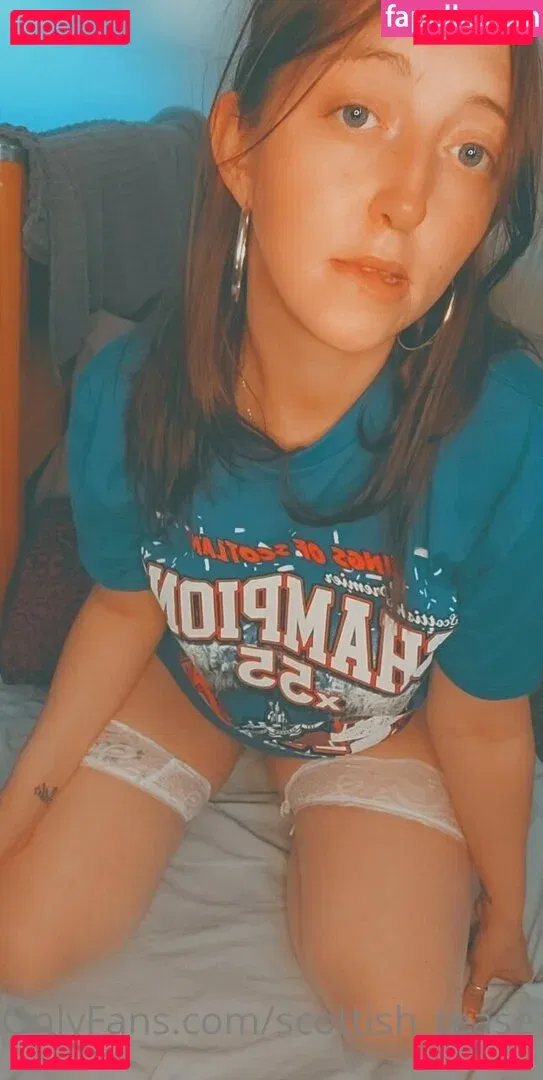 scottish_tease Onlyfans Photo Gallery 