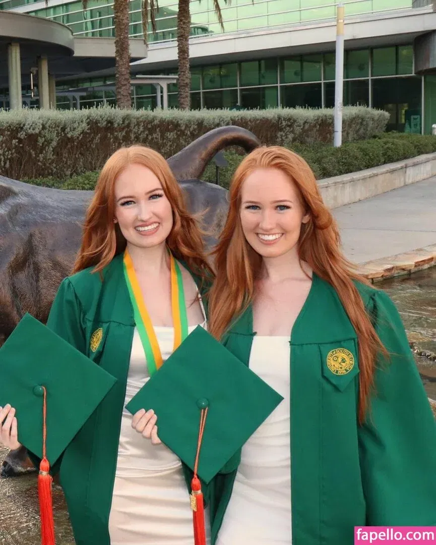 Burinski Twins Onlyfans Photo Gallery 