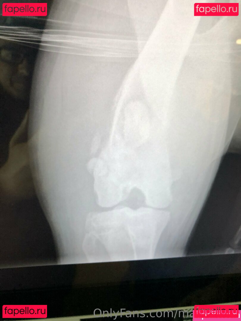 marlybeau / marlybeau_cottage Onlyfans Photo Gallery 