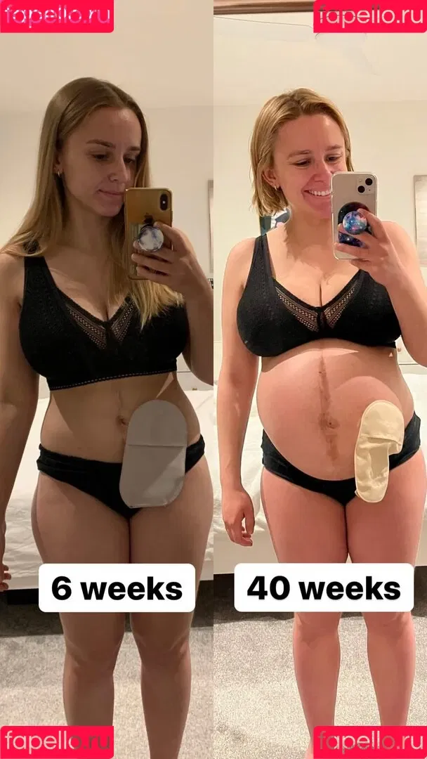 Hannah Witton Onlyfans Photo Gallery 
