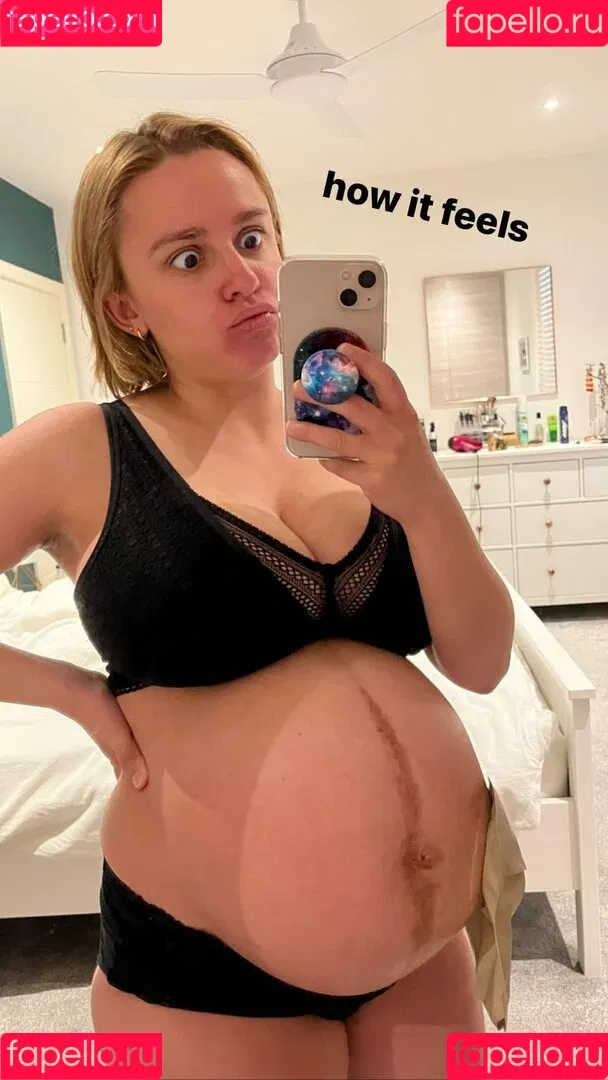 Hannah Witton Onlyfans Photo Gallery 