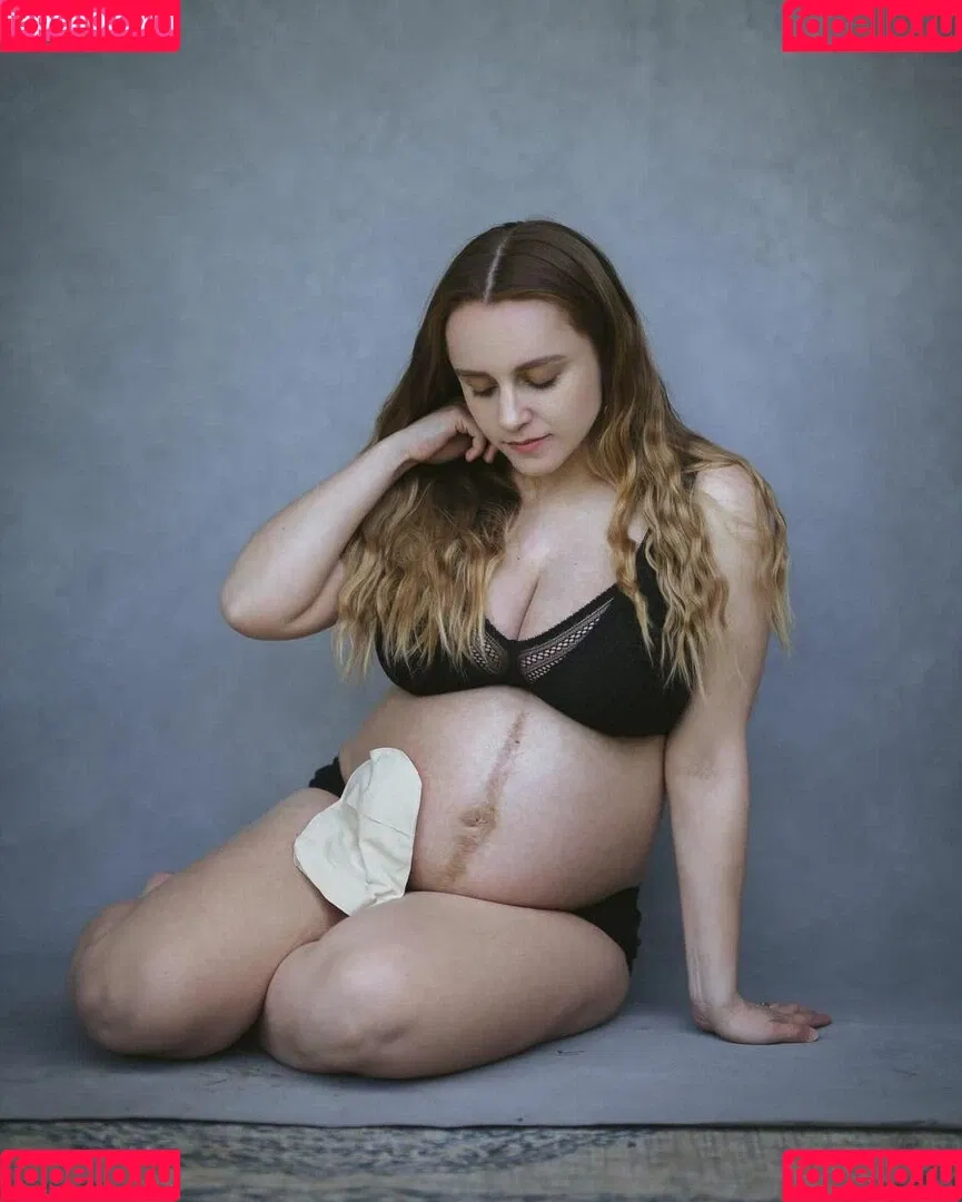 Hannah Witton Onlyfans Photo Gallery 
