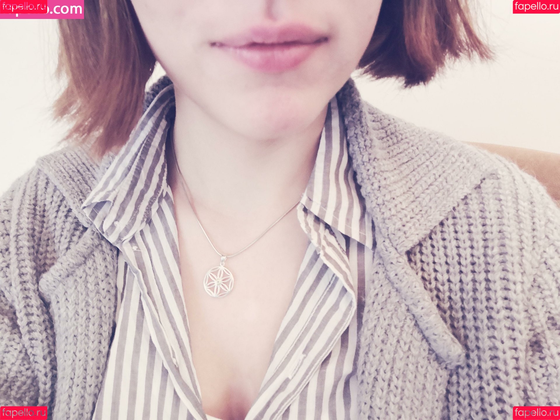 vitiligo95 Onlyfans Photo Gallery 