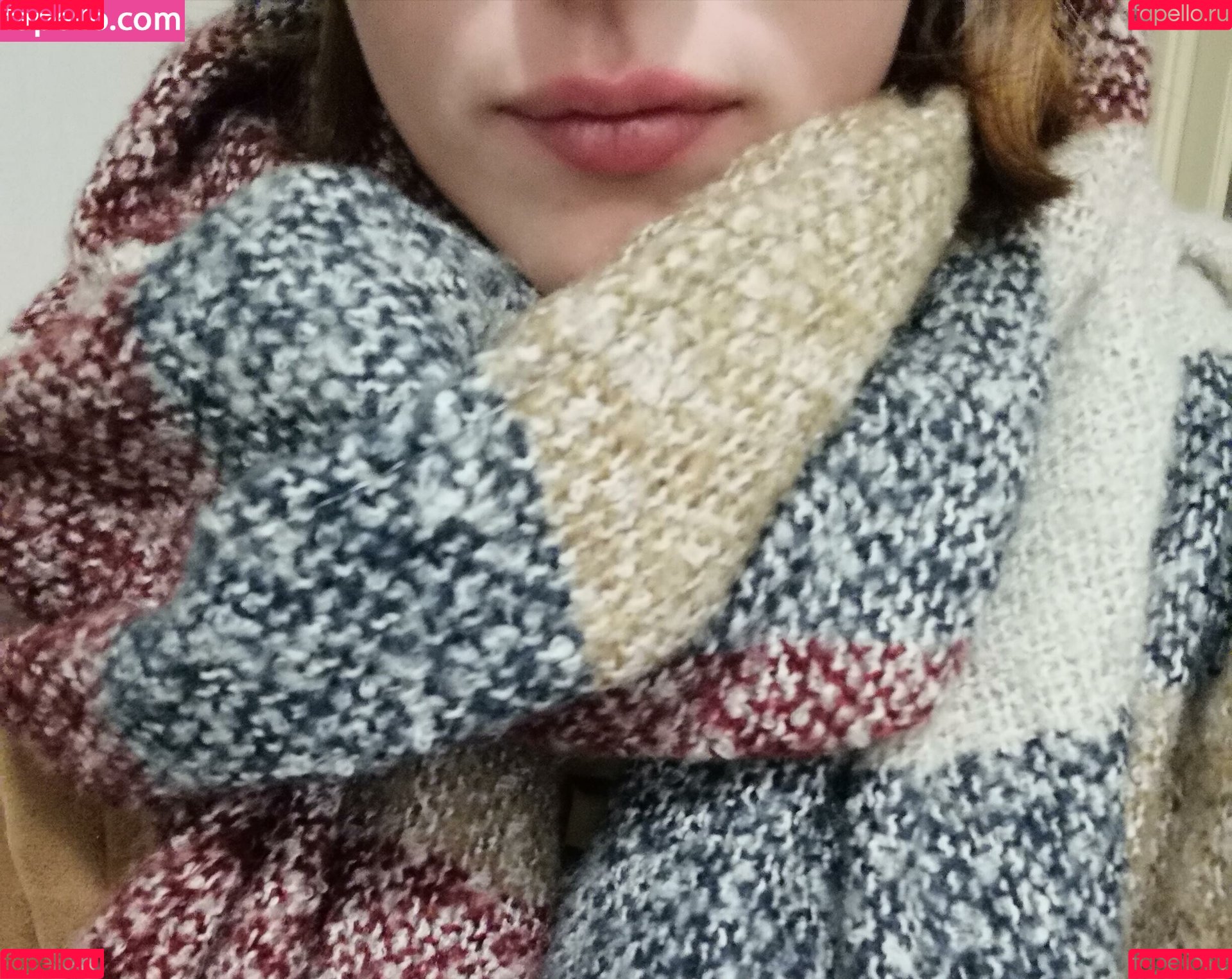 vitiligo95 Onlyfans Photo Gallery 