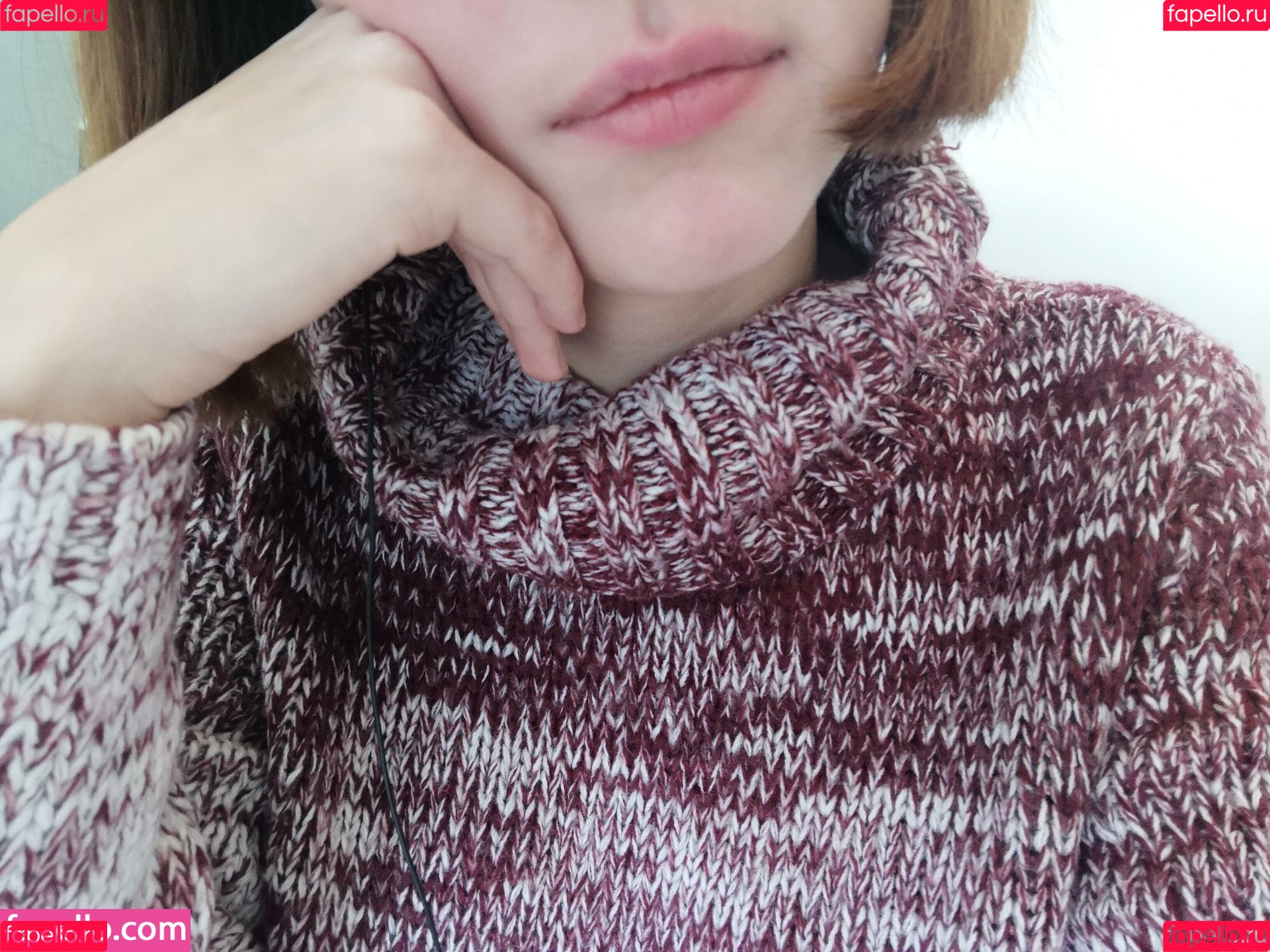 vitiligo95 Onlyfans Photo Gallery 