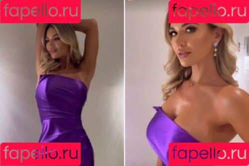 Christine McGuinness Onlyfans Photo Gallery 