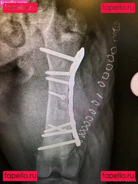 thesarahbnkx Onlyfans Photo Gallery 