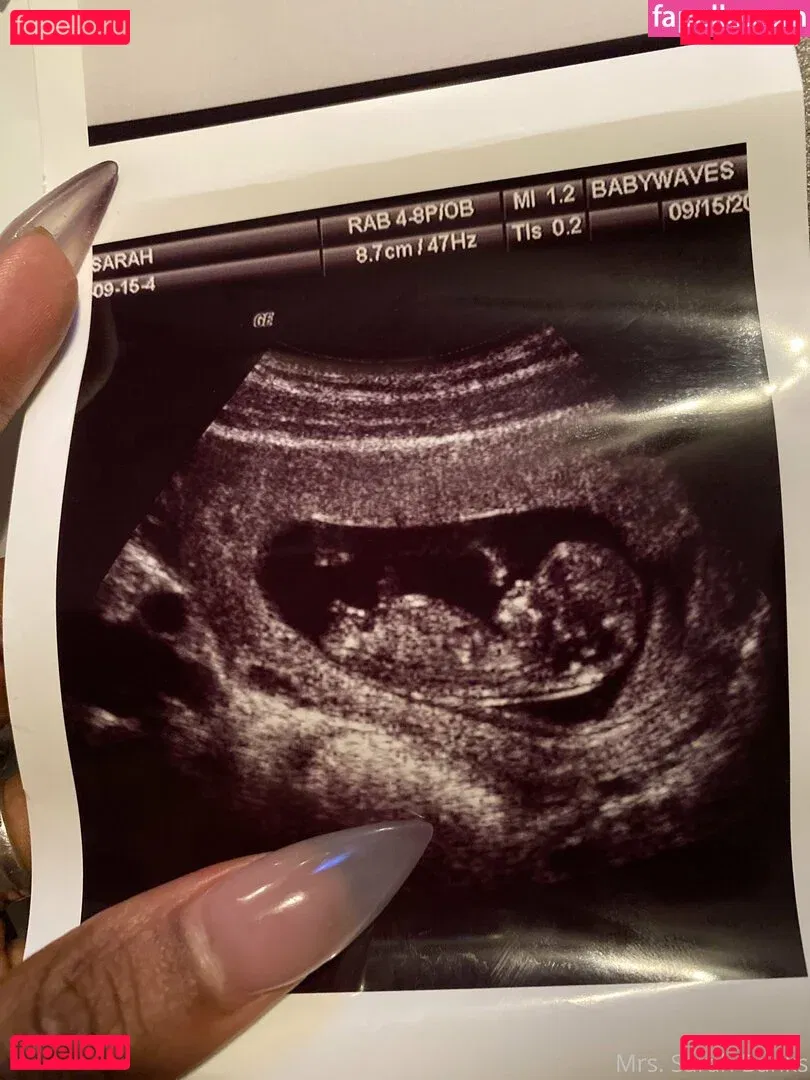 thesarahbnkx Onlyfans Photo Gallery 