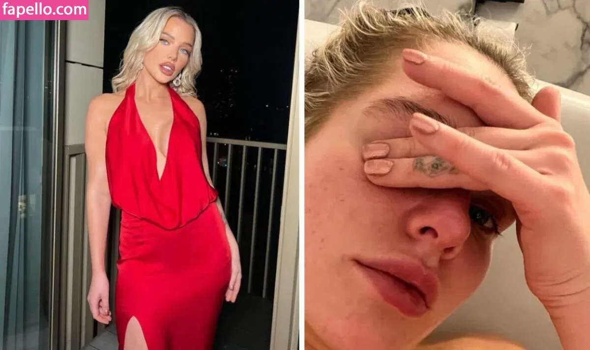 Helen Flanagan Onlyfans Photo Gallery 