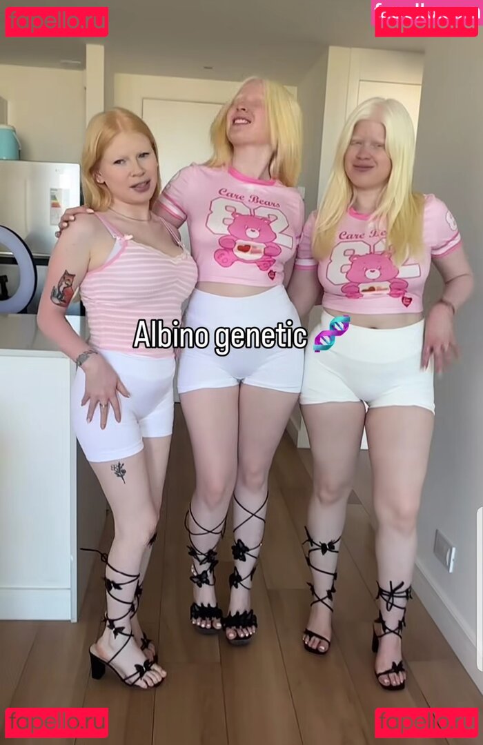 Albino Models Nude Onlyfans Photo 10