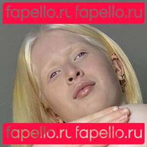 Albino Models Nude Onlyfans Photo 3