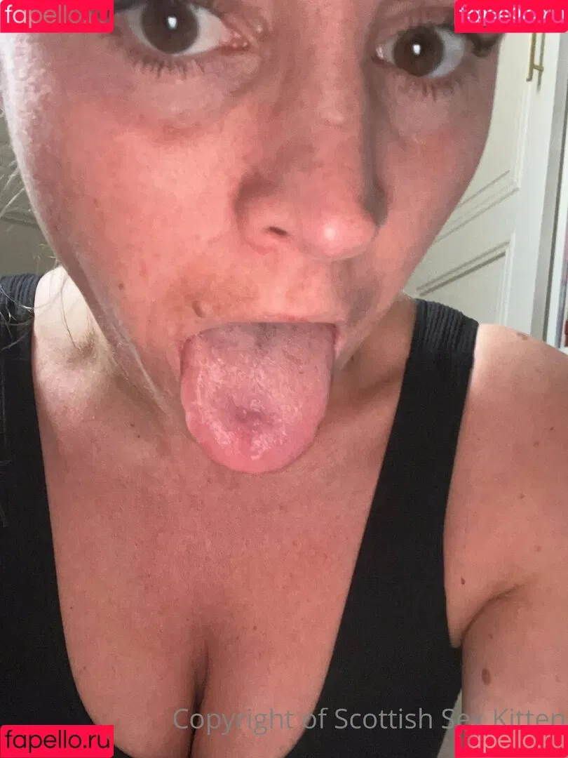 scottishsexkitten Onlyfans Photo Gallery 