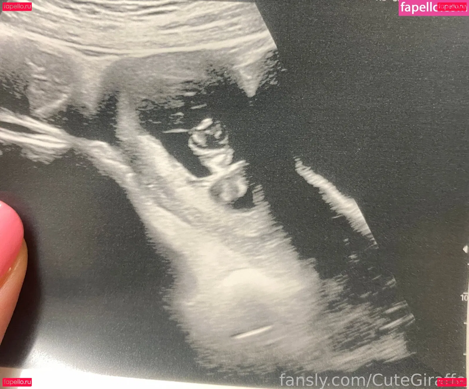 cutegiraffe Onlyfans Photo Gallery 